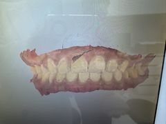 -爱齿尔口腔医院(中南院)
