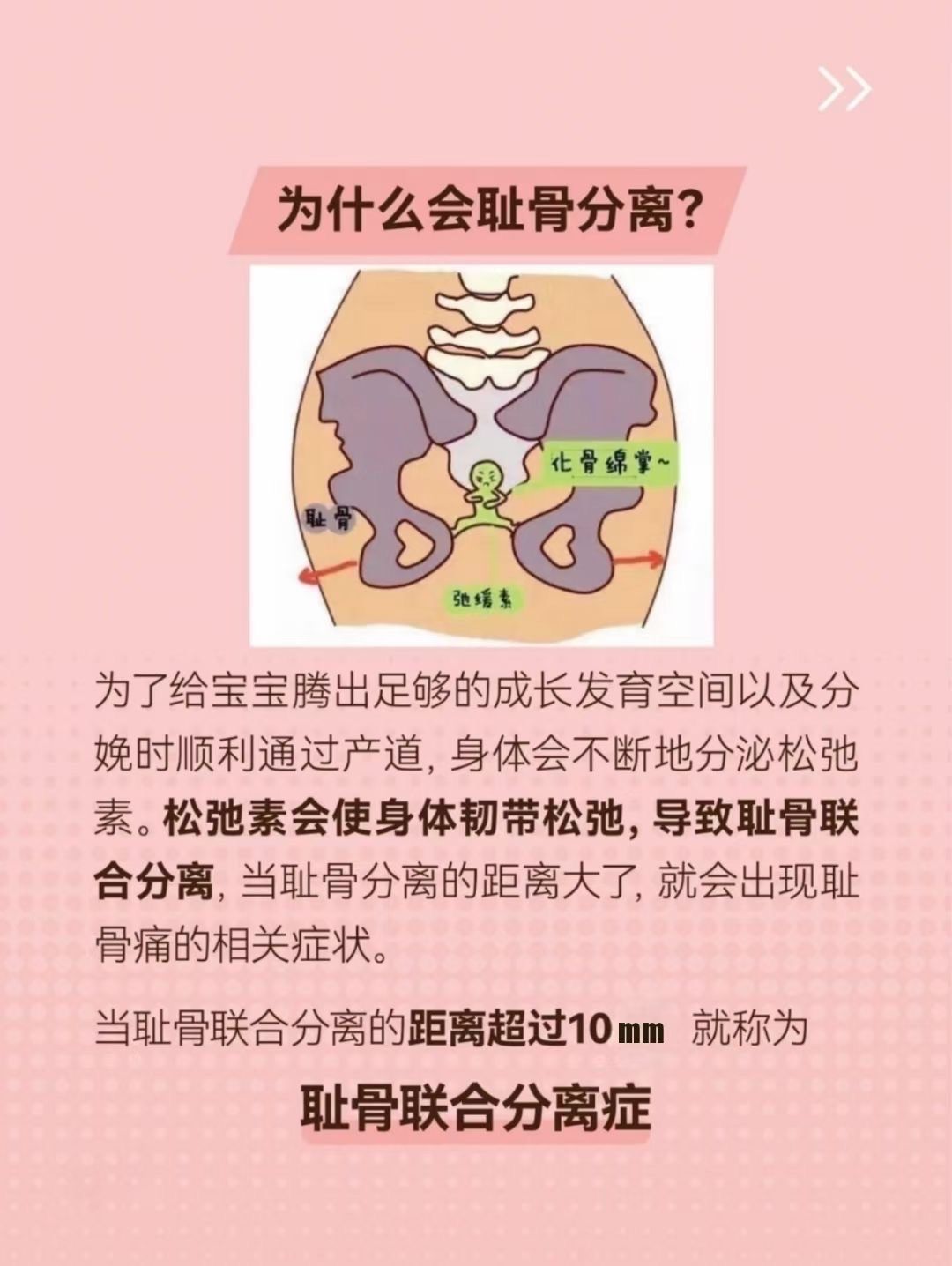 当耻骨联合分离的距离超过10mm 就称为耻骨联合分离症