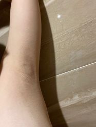 体验后-安琪儿医疗美容中心