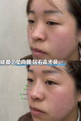 -Yestar艺星整形美容医院
