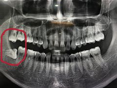-众鑫医疗小白牙口腔(土桥店)