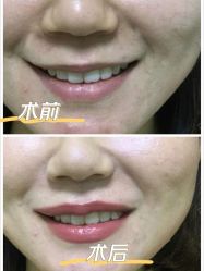 -伊丽莎白医疗美容
