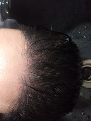 -熙朵美学植发连锁