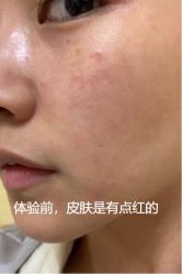 点击看大图 体验前-杭州海亮医院 · 禾芸嘉医美中心