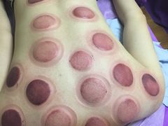 -沈师傅盲人按摩工作室(密三小区店)