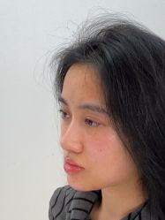 -长沙雅美医疗美容医院