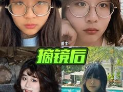 -博爱眼科体检中心·近视摘镜·医学验光配镜