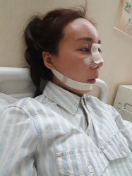 点击看大图 体验后-鑫元辰医疗美容整形