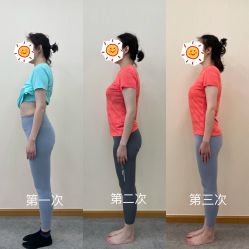 -卓拓普拉提