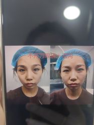 -天津健丽·去眼袋医疗美容机构