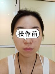 体验前-北京爱育华医院-医疗美容科