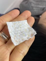 -瑶芳清颜草本祛痘