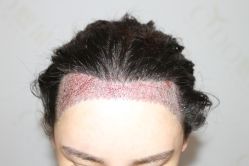 -熙朵美学植发·连锁品牌