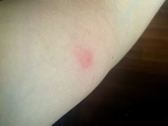 一家三口均被跳蚤咬了无数口-屋顶顶城市·江景酒店-客房部