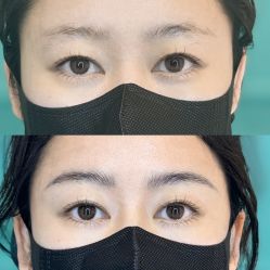 -杨益美学·野生眉半永久纹眉发际线