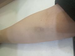 -广州仁爱天河医院体检中心