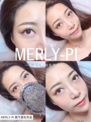 -MLP美丽派·问题肌疗愈中心