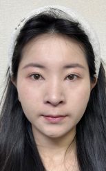 -四川米兰柏羽医学美容医院