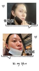 体验前-JS医疗美容