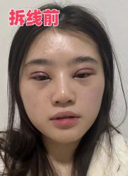 -素美医疗美容·西南眼鼻整形·修复基地