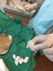 一次性使用的微针针头-北京米扬丽格医疗美容·联合丽格鼻整形中心