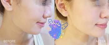 -SKINIST丽铂医疗美容