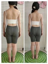-奕美功能性体态调整·塑型·产后恢复(永利国际店)