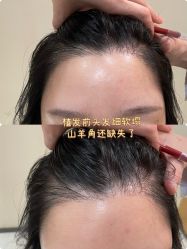 -雍禾植发全国连锁