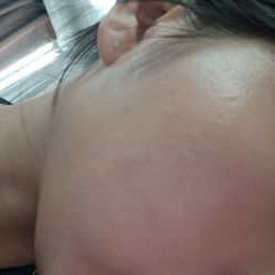 -广州美莱医疗美容医院