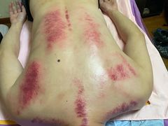 -沈师傅盲人按摩工作室(密三小区店)