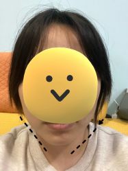 -针美汇欧邦医疗美容