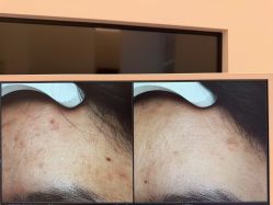 -苑苑vbeauty科技美容SPA