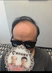 -唐风采假发补发定制