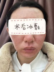 点击看大图 体验后-广州美莱医疗美容医院
