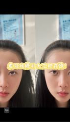 -雍禾植发全国连锁