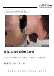 点击看大图 -MLP美丽派·问题肌疗愈中心