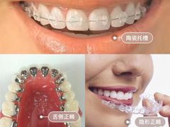 -浙江大学医学院附属口腔医院湖滨（延安）院区