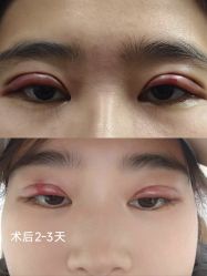 -JustHer宁波珈禾医疗美容医院