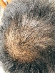 -发饰美男士增发补发假发定制店