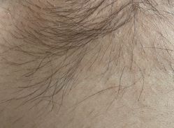 -咪咪专业脱毛连锁机构