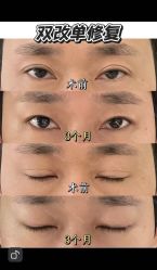 -联合丽格·张菡丽格医疗美容