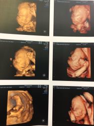 -杭州贝瑞斯美华妇儿医院·早孕·产检·儿科