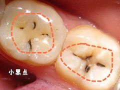 -团圆口腔·种植中心(锦江院区)
