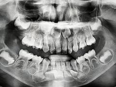 -宁波儿童口腔医院(钱湖院区)