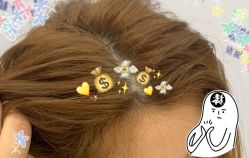 -大麦微针植发全国连锁