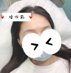 -久匠半永久纹眉