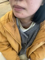 -长沙雅美医疗美容医院