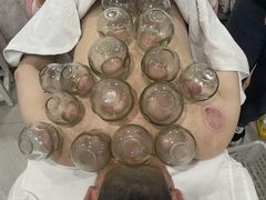 -刘大盲人推拿灸