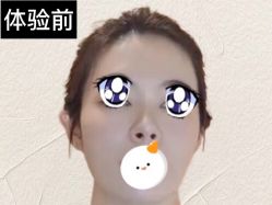 体验前-北京爱育华医院-医疗美容科