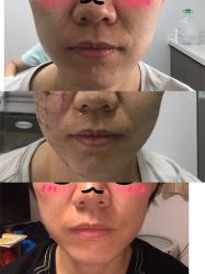 -小忠丽格医美